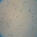 Microscope-Ale yeast.jpg