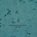 Microscope-calcium oxalate.jpg